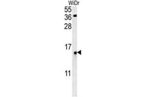C19orf50 antibody  (Middle Region)