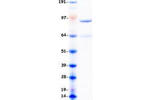 Image no. 1 for DNA (Cytosine-5-)-Methyltransferase 3 beta (DNMT3B) (Transcript Variant 1) protein (Myc-DYKDDDDK Tag) (ABIN2719618)