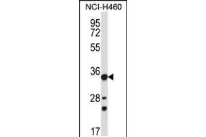 Image no. 1 for anti-Aldo-Keto Reductase Family 1, Member B10 (Aldose Reductase) (AKR1B10) (AA 101-130) antibody (ABIN5533683)