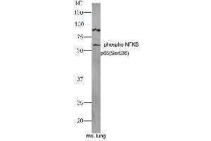 Image no. 3 for anti-Nuclear Factor-kB p65 (NFkBP65) (pSer536) antibody (ABIN730528)