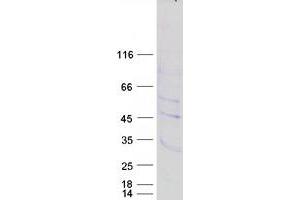 Image no. 1 for Prostate Tumor Overexpressed 1 (PTOV1) protein (Myc-DYKDDDDK Tag) (ABIN2730093)