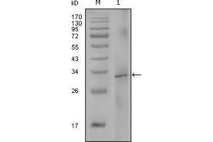 Image no. 1 for anti-Coagulation Factor VIII (F8) antibody (ABIN969123)
