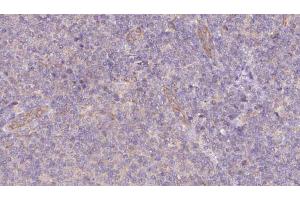 Image no. 1 for anti-SNAP-Associated Protein (SNAPIN) (N-Term) antibody (ABIN6265206)