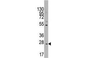 Image no. 3 for anti-CD8b Molecule (CD8B) (AA 64-92) antibody (ABIN3028556)
