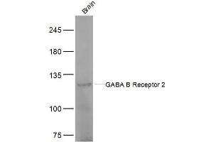 Image no. 3 for anti-gamma-aminobutyric Acid (GABA) B Receptor, 2 (GABBR2) (AA 501-650) antibody (ABIN674544)