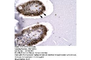 Image no. 1 for anti-Sirtuin 5 (SIRT5) (C-Term) antibody (ABIN2779612)