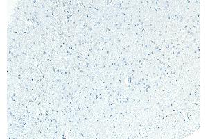 Image no. 1 for anti-Patched 1 (PTCH1) (C-Term) antibody (ABIN185521)