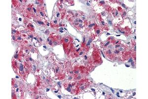 Image no. 4 for anti-T-Cell Acute Lymphocytic Leukemia 1 (TAL1) (C-Term) antibody (ABIN6741621)