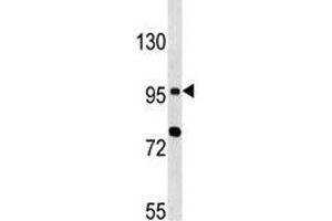 Image no. 2 for anti-Toll-Like Receptor 6 (TLR6) (AA 1-30) antibody (ABIN3029175)