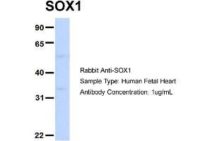 Image no. 3 for anti-SRY (Sex Determining Region Y)-Box 1 (SOX1) (Middle Region) antibody (ABIN2777427)