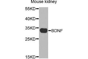 Image no. 1 for anti-Brain-Derived Neurotrophic Factor (BDNF) antibody (ABIN3021893)