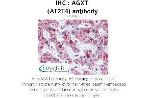 Image no. 1 for anti-Alanine Glyoxylate Aminotransferase (AGXT) antibody (ABIN1724370)