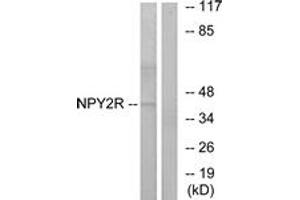 Image no. 1 for anti-Neuropeptide Y Receptor Y2 (NPY2R) (AA 1-50) antibody (ABIN1535789)