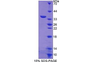 Image no. 1 for Lymphocyte Antigen 75 (LY75) (AA 216-503) protein (T7 tag,His tag) (ABIN6236762)