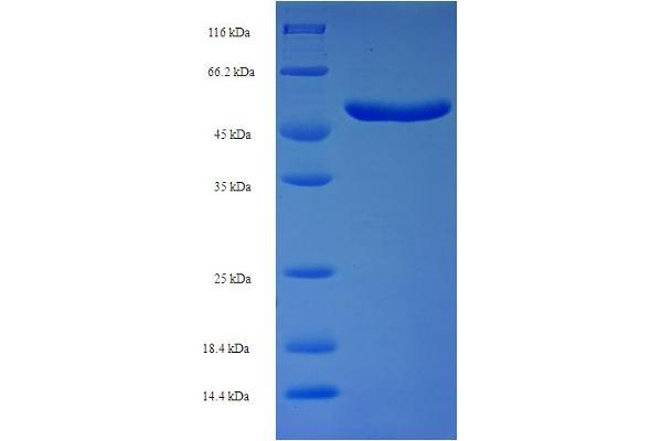 FANK1 Protein (Fibronectin Type III and Ankyrin Repeat Domains 1) (AA 1-345, full length) (His-SUMO Tag)