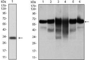 Image no. 4 for anti-Keratin 5 (KRT5) antibody (ABIN1106933)