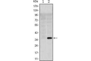 Image no. 2 for anti-Solute Carrier Family 22 (Organic Cation Transporter), Member 1 (SLC22A1) antibody (ABIN1109041)