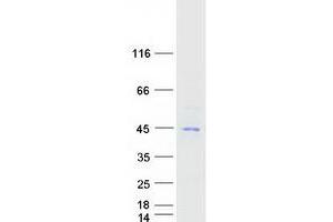 Image no. 1 for Chitinase 3-Like 1 (Cartilage Glycoprotein-39) (CHI3L1) protein (Myc-DYKDDDDK Tag) (ABIN2713970)