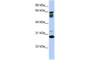 Image no. 1 for anti-Transmembrane Protein 187 (TMEM187) (Middle Region) antibody (ABIN2782233)