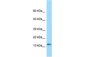 Image no. 1 for anti-MKL/myocardin-Like 2 (MKL2) (N-Term) antibody (ABIN2784235)