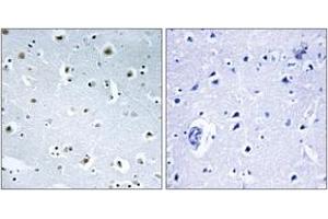 Image no. 1 for anti-Tubulin, gamma Complex Associated Protein 3 (TUBGCP3) (AA 201-250) antibody (ABIN1534926)