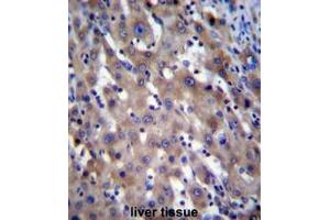 Image no. 1 for anti-Retinitis Pigmentosa GTPase Regulator (RPGR) (AA 743-772), (C-Term) antibody (ABIN954582)