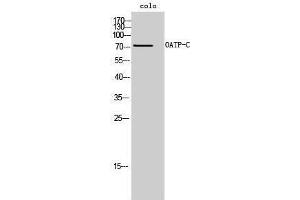 Image no. 1 for anti-Solute Carrier Organic Anion Transporter Family, Member 1B1 (SLCO1B1) (Internal Region) antibody (ABIN3185986)