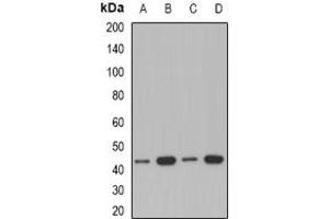 Image no. 1 for anti-Acetyl-CoA Acyltransferase 1 (ACAA1) (full length) antibody (ABIN6005604)