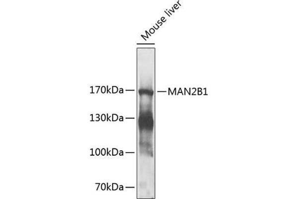 MAN2B1 Antikörper  (AA 640-850)