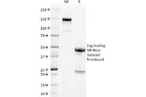 Image no. 1 for anti-Placental Alkaline Phosphatase (ALPP) antibody (ABIN6939455)