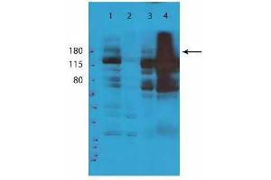 Image no. 1 for anti-Tet Methylcytosine Dioxygenase 2 (TET2) (N-Term) antibody (ABIN5596979)