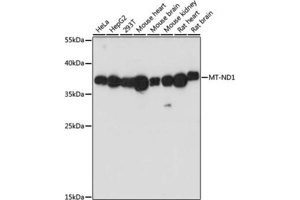 MT-ND1 antibody