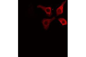 Image no. 3 for anti-Caveolin 1, Caveolae Protein, 22kDa (CAV1) (pTyr14) antibody (ABIN6255810)