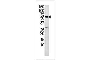 Image no. 1 for anti-Pantothenate Kinase 2 (PANK2) (AA 180-210) antibody (ABIN391238)