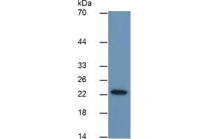 Image no. 3 for Glutathione S-Transferase pi 1 (GSTP1) ELISA Kit (ABIN6574253)