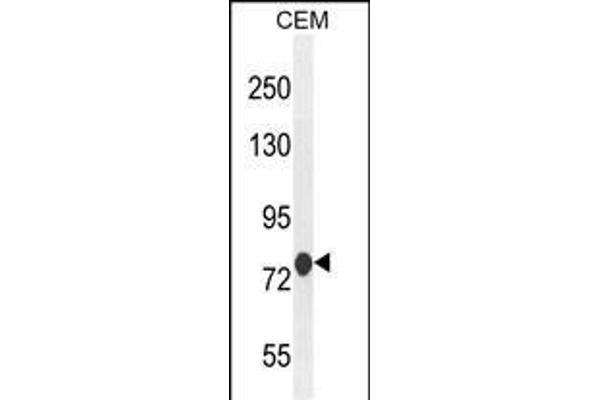 ATF7IP2 antibody  (AA 318-347)