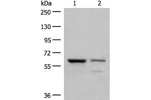 Western blot analysis of Human left kidney cancer tissue and HEPG2 cell lysates using HNF1A Polyclonal Antibody at dilution of 1:200