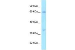Image no. 1 for anti-Hydroxysteroid (17-Beta) Dehydrogenase 3 (HSD17B3) (AA 51-100) antibody (ABIN6747984)
