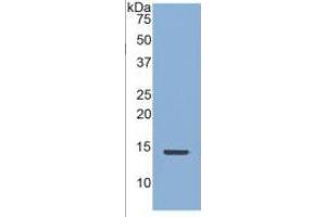 Image no. 6 for Connective Tissue Growth Factor (CTGF) ELISA Kit (ABIN6730903)