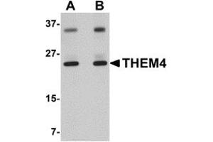 Image no. 1 for anti-Thioesterase Superfamily Member 4 (THEM4) (Middle Region) antibody (ABIN1031123)