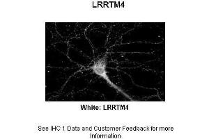 Image no. 2 for anti-Leucine Rich Repeat Transmembrane Neuronal 4 (LRRTM4) (Middle Region) antibody (ABIN2783963)
