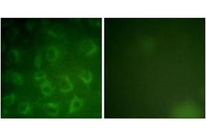 Immunofluorescence analysis of COS7 cells, using PDGFR beta (Ab-1021) Antibody.