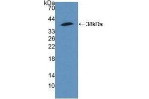 alpha Actinin 4 antibody  (AA 1-269)