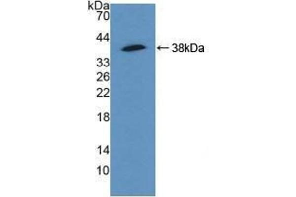 alpha Actinin 4 抗体  (AA 1-269)