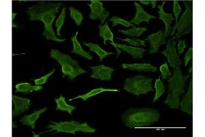 Immunofluorescence of monoclonal antibody to PPP1R1B on HeLa cell.