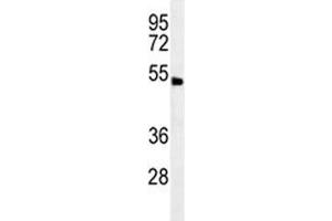 Image no. 1 for anti-Abhydrolase Domain Containing 8 (ABHD8) (AA 410-439) antibody (ABIN5647671)