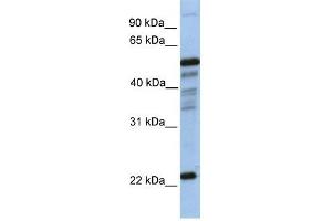 Image no. 1 for anti-Prostaglandin D2 Synthase (PTGDS) (N-Term) antibody (ABIN630955)
