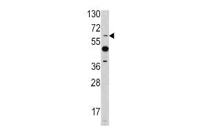 Western blot analysis of ETV4 antibody (C-term) (ABIN390582 and ABIN2840905) in mouse heart tissue lysates (35 μg/lane).