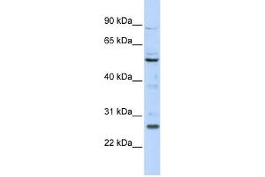 Image no. 1 for anti-Homeobox C5 (HOXC5) (N-Term) antibody (ABIN2781077)