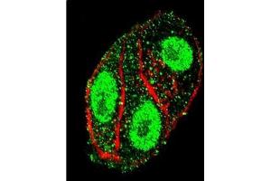 Image no. 1 for anti-Surfactant Protein C (SFTPC) (AA 1-30), (N-Term) antibody (ABIN954775)